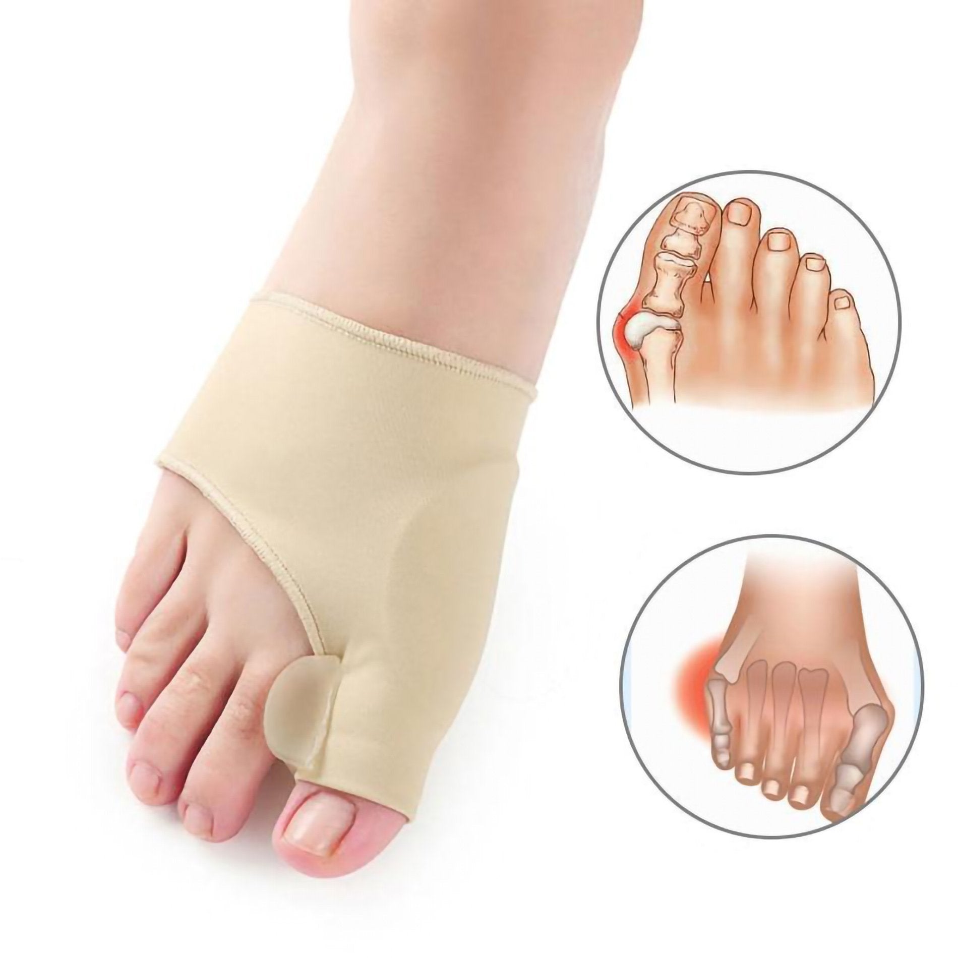 Socksya™ Bunion Orthopedic Corrector Sleeve - (New 2021 with silicone separator) - Socksya™